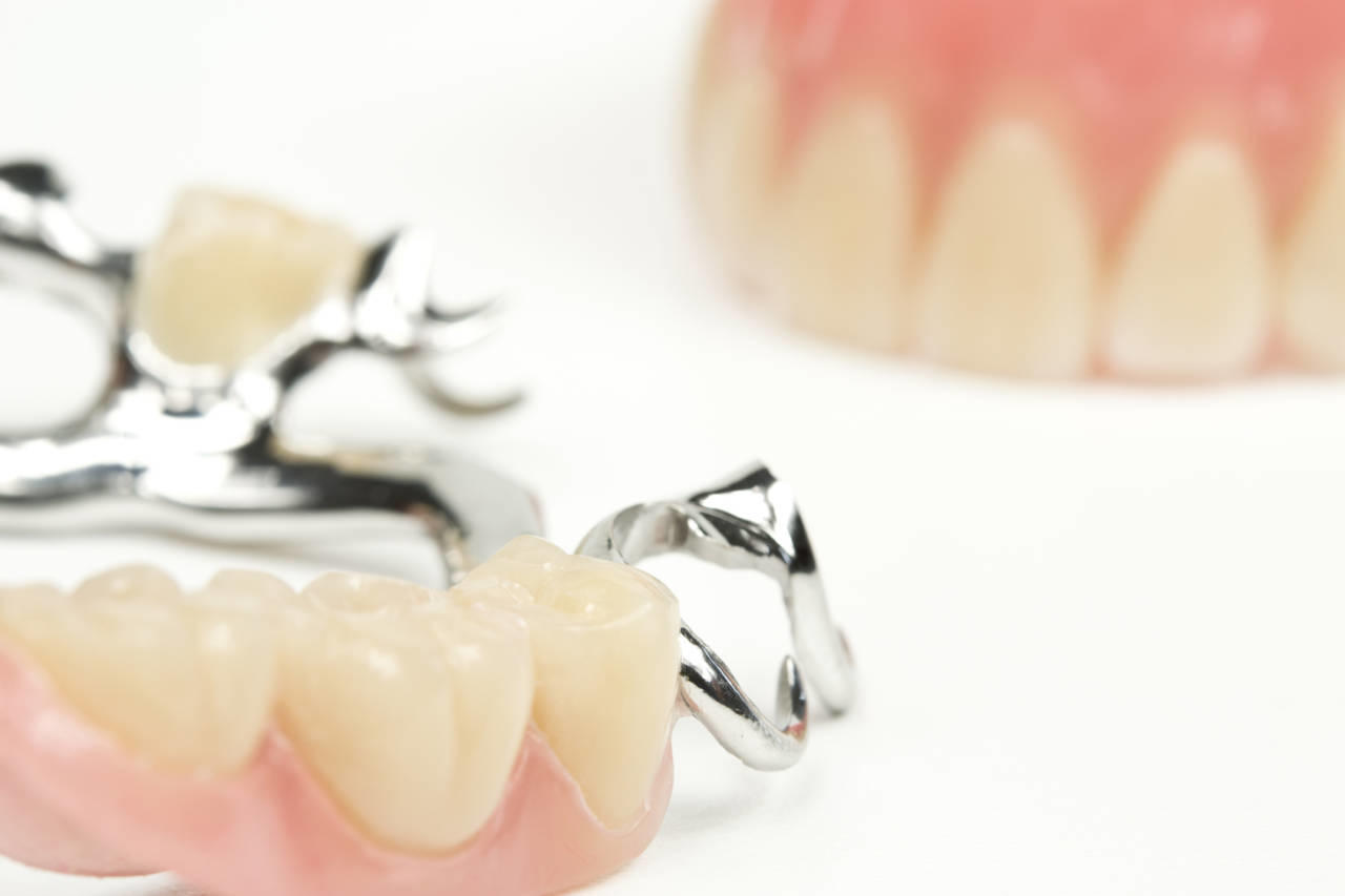 Protesi dentale Protesi dentale