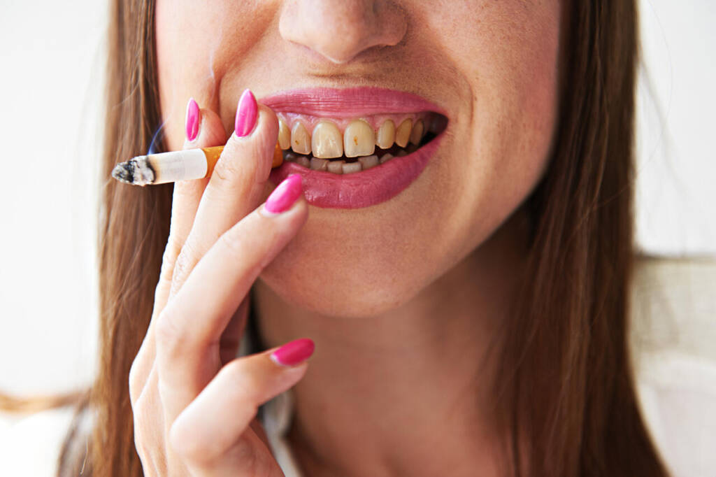 Smiley,Woman,With,Yellow,Dirty,Teeth,Holding,Cigarette