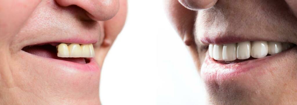 shutterstock_1315375181