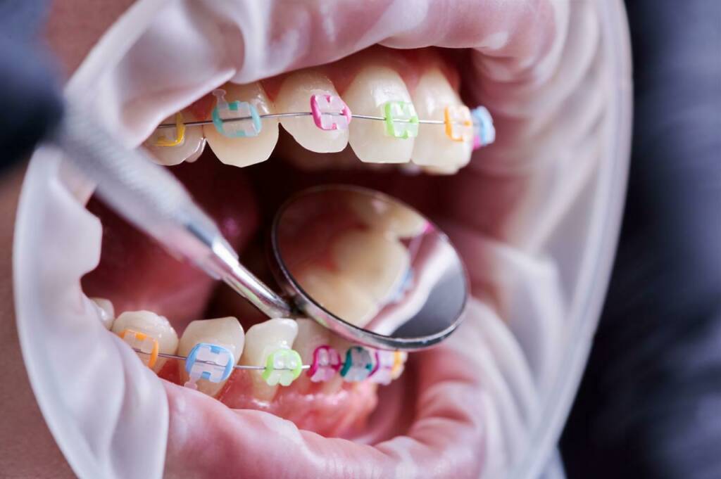 shutterstock_1916918357