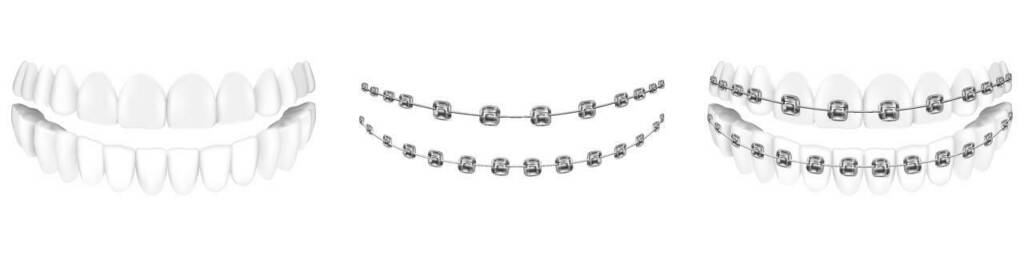 shutterstock_2014040999